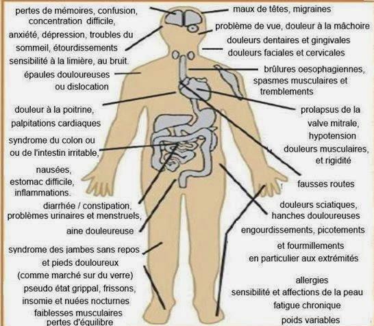 Fibromyalgie consequences bis